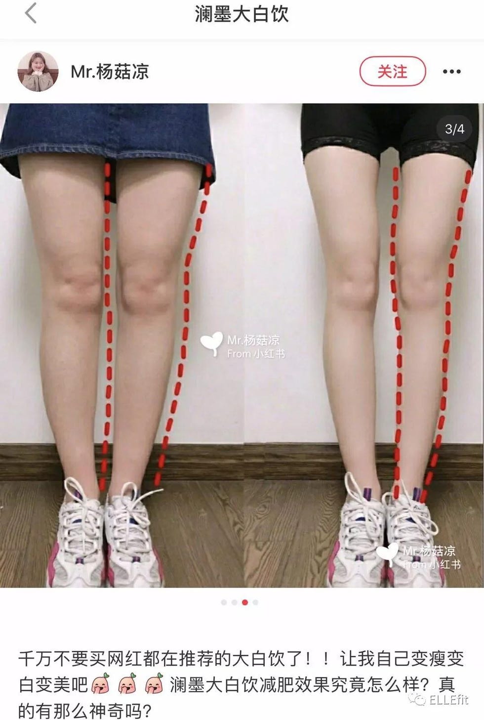 Leg, Thigh, Clothing, Tights, Human leg, Joint, Stocking, Knee, Human body, Ankle, 