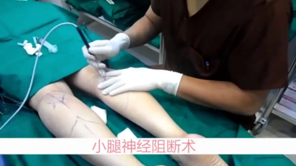 手术